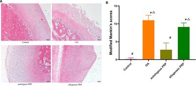 Comparison of the effects of autologous and allogeneic purified platelet-rich plasma on cartilage damage in a rabbit model of knee osteoarthritis